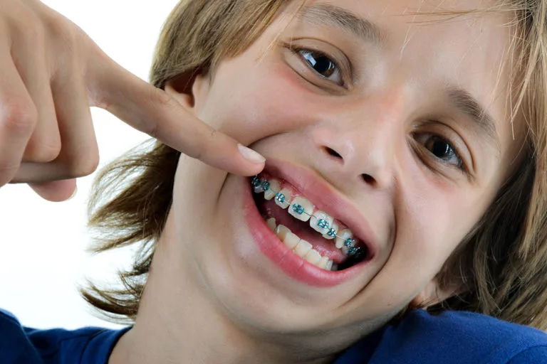 Dentist Castle hill - photo of a young child with braces