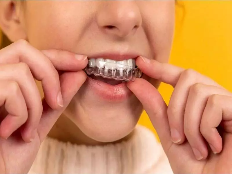 Childrens Mouth Guard Castle Hill Dental Care