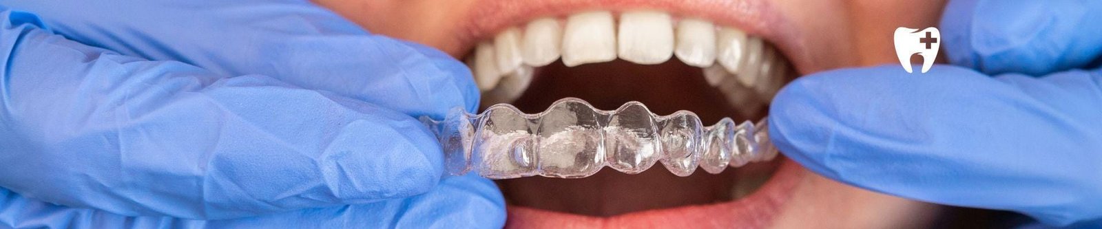 Orthodontics Invisalign promo Image 1920x400px