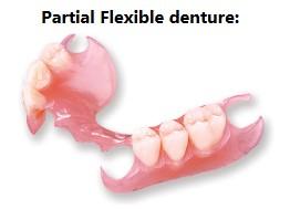 Partial flexible denture at castle hill dental care